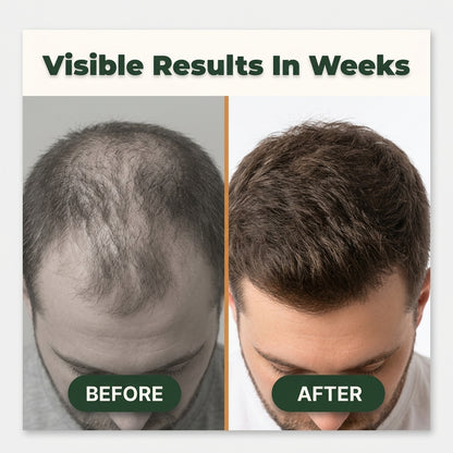 Ginger Hair & Scalp Spray — Support Fuller-Looking Hair Without Heavy, Greasy Treatments